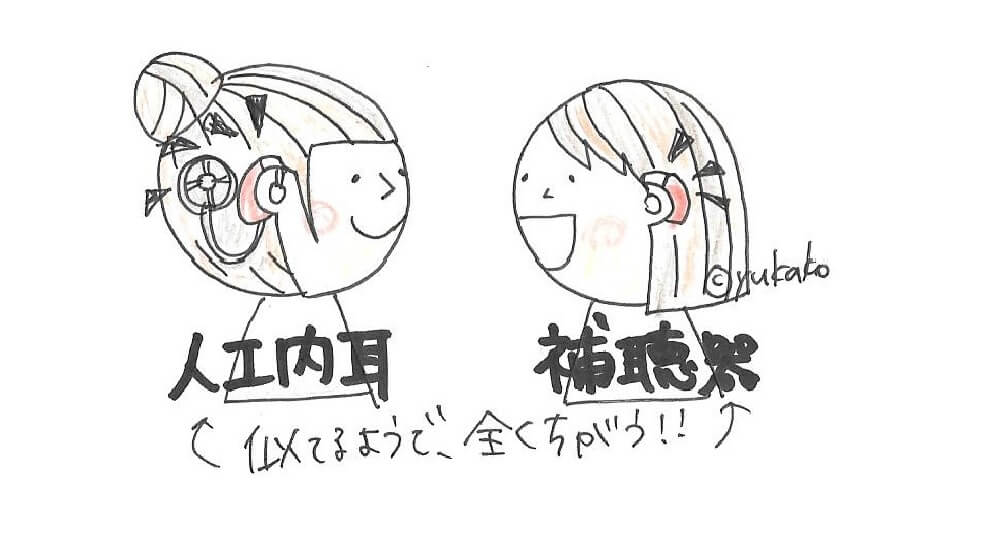 【分かりやすい！】人工内耳のキホンについて徹底解説！