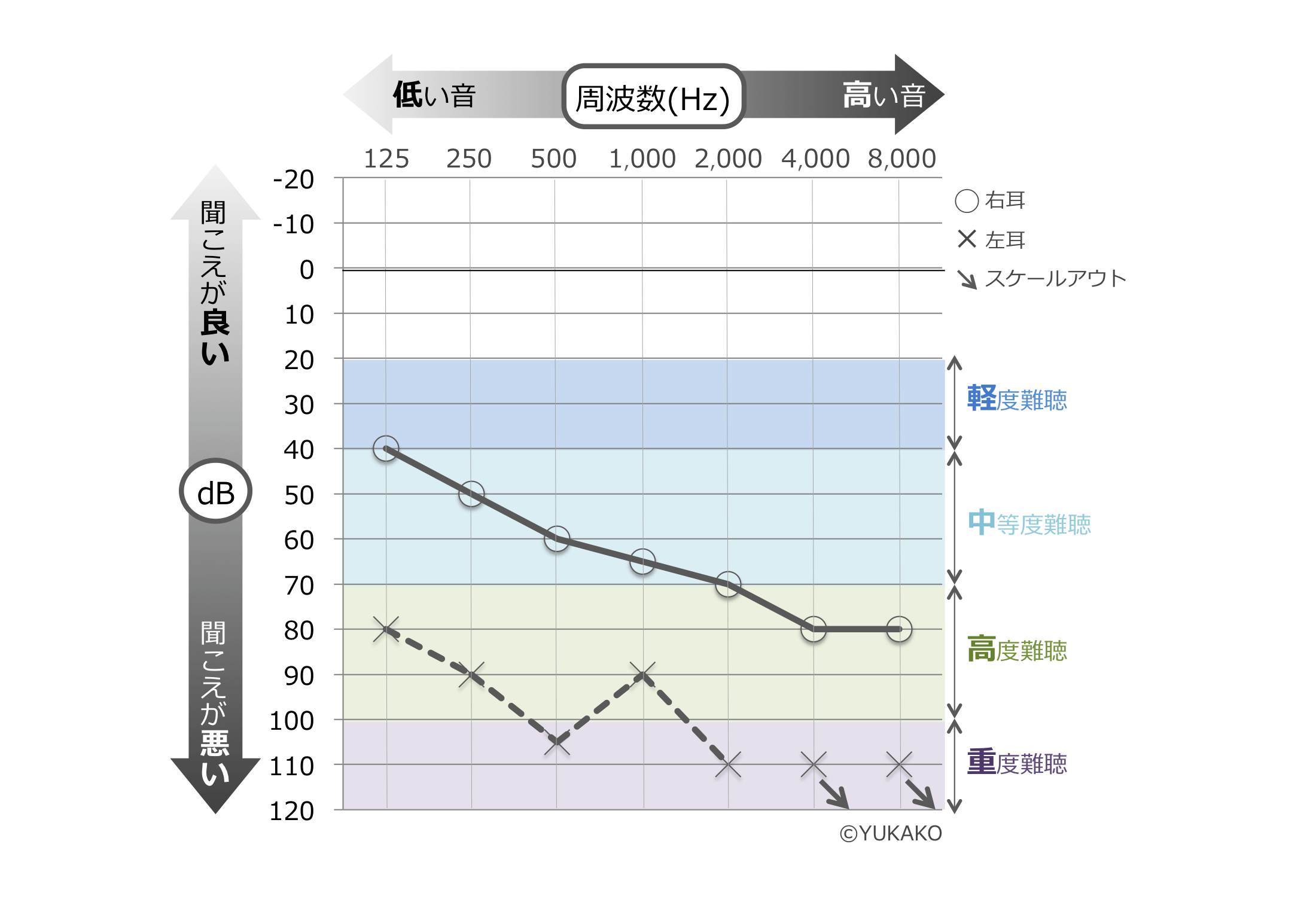 ここだけは必ず確認すべき！聴力検査結果【オージオグラム】の徹底解説！